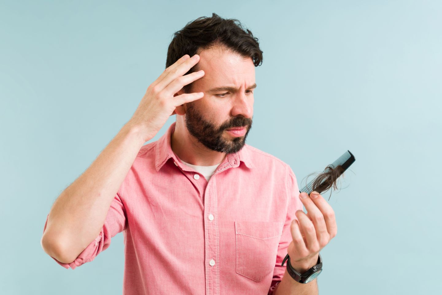 Haarausfall bei Männern – Ursachen verstehen und wirksame Behandlungen finden. Haarausfall bei Männern: Ursachen, Prävention und Lösungen für Männerhaarausfall.